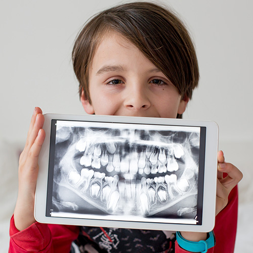 A child holding an x-ray of their teeth