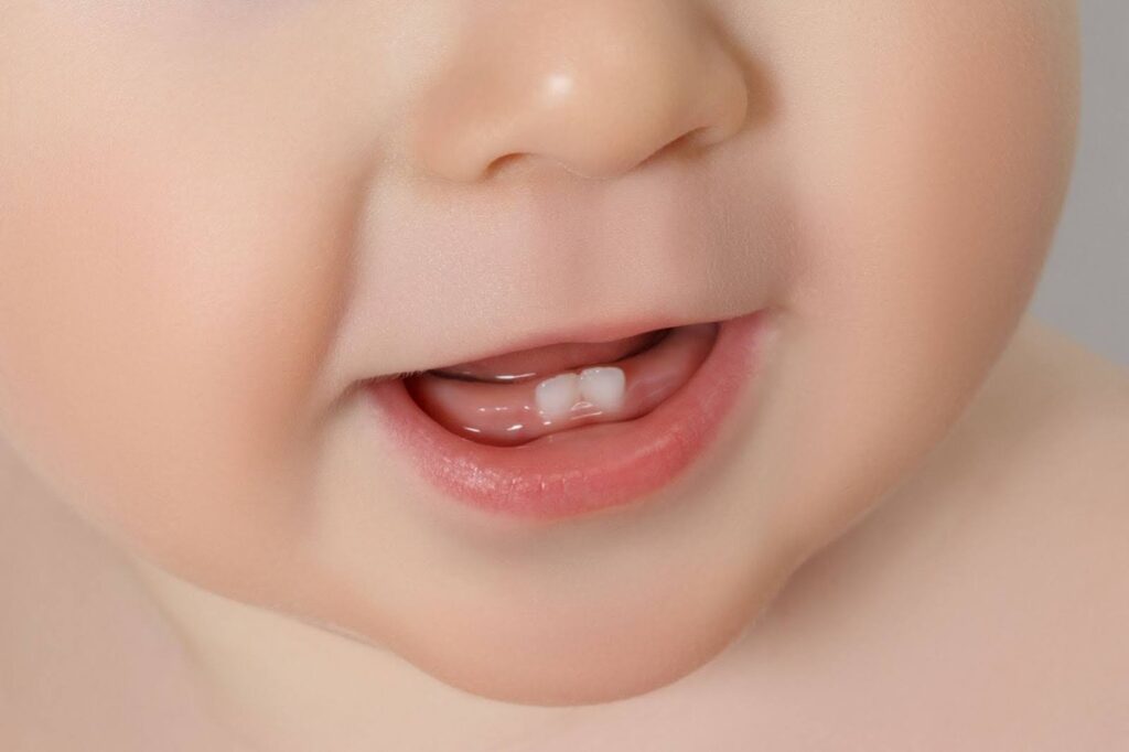 Importance of baby teeth - reserving space in the gums