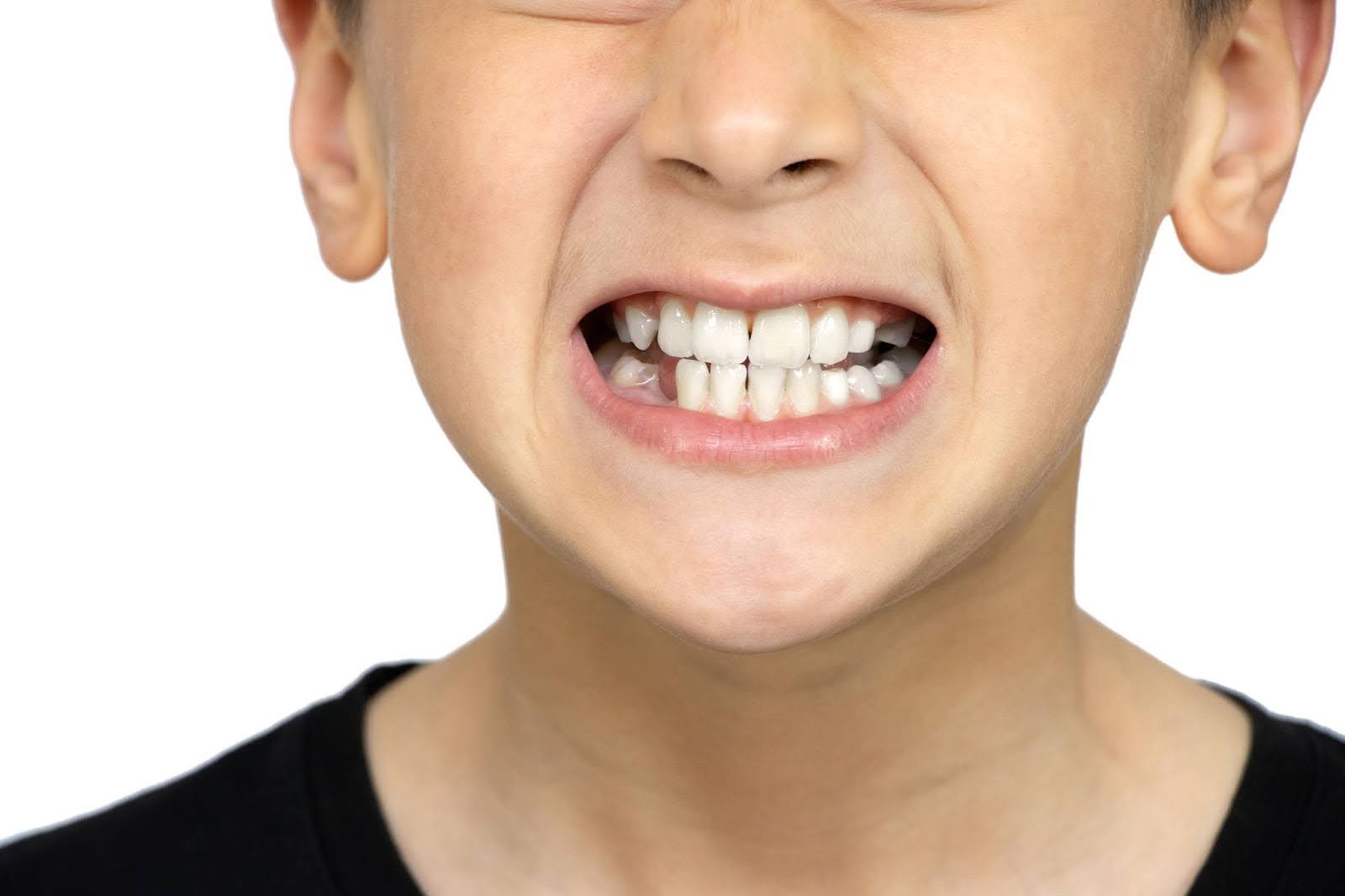 What to do for TMJ and teeth grinding in kids