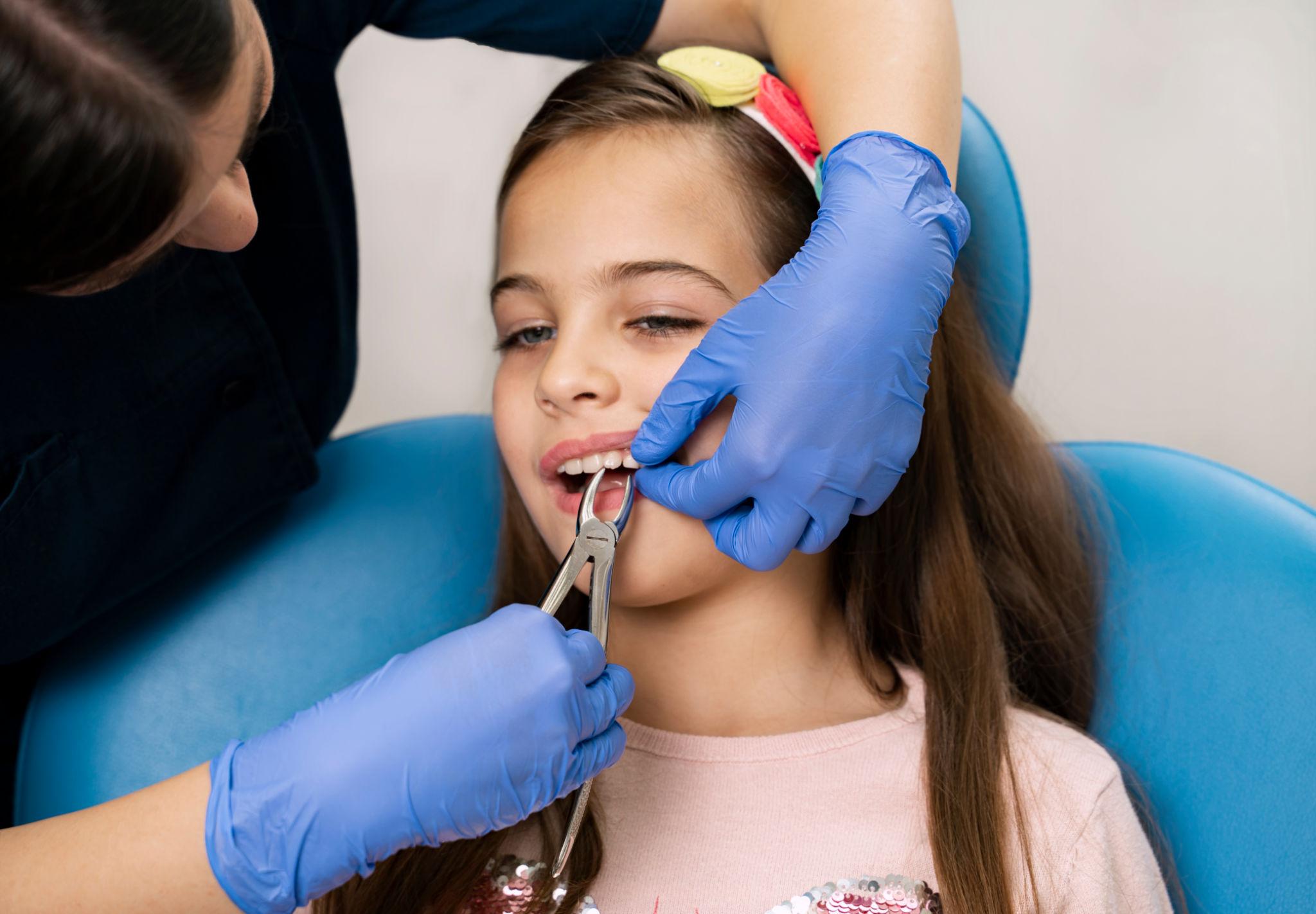 Baby tooth extraction in raleigh nc